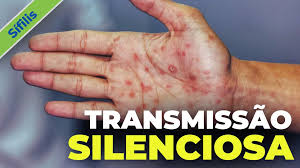 Brasil registra crescimento contínuo da sífilis